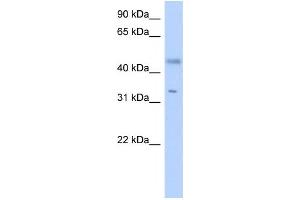 Western Blotting (WB) image for anti-Epidermal Retinal Dehydrogenase 2 (RDHE2) antibody (ABIN2459555) (SDR16C5 Antikörper)
