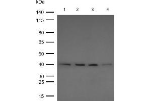 All lanes : BMP6 Rabbit mAb at 1/1k dilution Lane 1 : Mouse Lung lysates Lane 2 : Rat Brain lysates Lane 2 : Rat Kidney lysates Lane 3 : Rat Lung lysates Lysates/proteins at 20 μg per lane. (Rekombinanter BMP6 Antikörper)