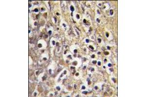 AP14221PU-N CYP19A1 antibody staining of Formalin-Fixed, Paraffin-Embedded Human placenta tissue using peroxidase-conjugate and DAB chromogen. (Aromatase Antikörper  (C-Term))