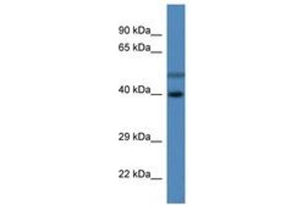 HSDL1 Antikörper  (C-Term)