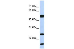 UBE2L6 antibody used at 1 ug/ml to detect target protein.