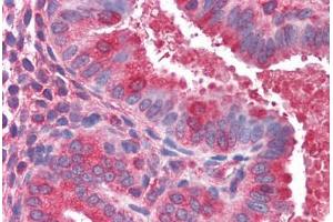 Human Uterus (formalin-fixed, paraffin-embedded) stained with ACTR1B antibody ABIN351475 at 3. (ACTR1B Antikörper  (AA 363-375))