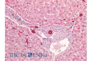ABIN1781977 (5µg/ml) staining of paraffin embedded Human Liver. (Cytokeratin 19 Antikörper  (C-Term))