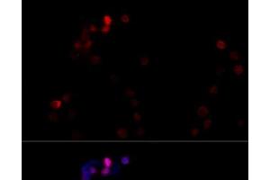 Immunofluorescence analysis of NIH/3T3 cells using TBP Polyclonal Antibody at dilution of 1:100 (40x lens). (TBP Antikörper)