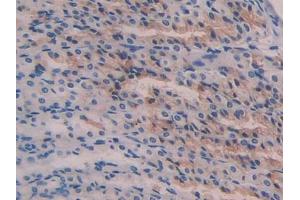 Used in DAB staining on fromalin fixed paraffin- embedded stomach tissue (Reelin Antikörper  (AA 2400-2610))