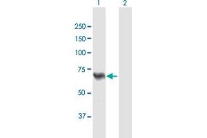 Western Blot analysis of ACSL5 expression in transfected 293T cell line by ACSL5 MaxPab polyclonal antibody. (ACSL5 Antikörper  (AA 1-739))