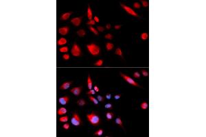 Immunofluorescence analysis of U2OS cells using KIF2C antibody (ABIN5973166).