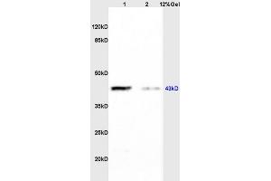 Lane 1: rat brain lysates Lane 2: rat heart lysates probed with Anti CK II alpha/STKPolyclonal Antibody, Unconjugated (ABIN731978) at 1:200 in 4 °C. (CSNK2A1/CK II alpha Antikörper  (AA 201-300))