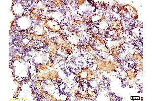 Formalin-fixed and paraffin embedded rat liver tissue with Anti-Collagen IV Polyclonal Antibody, Unconjugated (ABIN728413) at 1:200, followed by conjugation to the secondary antibody and DAB staining