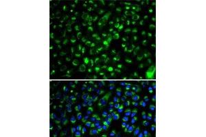 Immunofluorescence analysis of HeLa cells using CYP2E1 Polyclonal Antibody