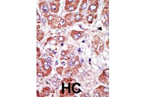 Immunohistochemistry (IHC) image for anti-Plasminogen Activator, Urokinase Receptor (PLAUR) antibody (ABIN3003728) (PLAUR Antikörper)