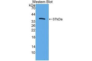 Western Blotting (WB) image for anti-Trefoil Factor 3 (Intestinal) (TFF3) antibody (Biotin) (ABIN1174902) (TFF3 Antikörper  (Biotin))