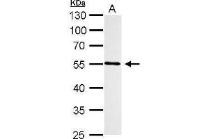 WB Image CYP1B1 antibody detects CYP1B1 protein by Western blot analysis. (CYP1B1 Antikörper  (Center))