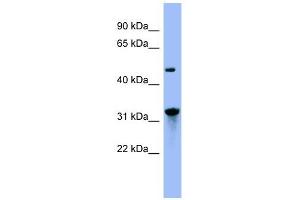 NIT1 antibody used at 1 ug/ml to detect target protein. (Nitrilase 1 Antikörper  (N-Term))