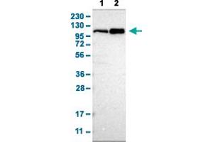 Western Blot analysis with CUL4B polyclonal antibody . (Cullin 4B Antikörper  (AA 9-152))