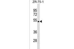 CHST5 Antibody (C-term) (ABIN1536997 and ABIN2850338) western blot analysis in ZR-75-1 cell line lysates (35 μg/lane).