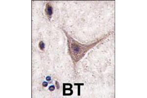 Immunohistochemistry (IHC) image for anti-Cadherin 10, Type 2 (T2-Cadherin) (CDH10) (AA 495-523), (C-Term) antibody (ABIN5535226)