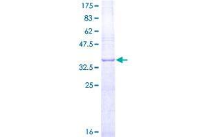 Image no. 1 for Fibroblast Growth Factor 2 (Basic) (FGF2) (AA 189-288) protein (GST tag) (ABIN1354014)