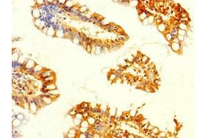 Immunohistochemistry of paraffin-embedded human small intestine tissue using ABIN7160672 at dilution of 1:100 (GALK2 Antikörper  (AA 161-458))