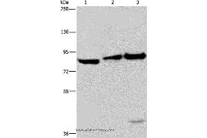 Western blot analysis of NIH/3T3 cell, mouse lung and liver tissue, using ECE1 Polyclonal Antibody at dilution of 1:550 (ECE1 Antikörper)