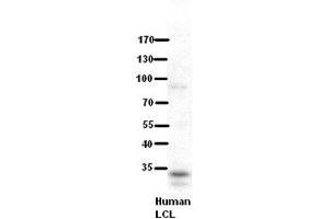 WB Suggested Anti-RRP1B Antibody Titration:  5% Milk  ELISA Titer:  dilution: 1:500  Positive Control:  human LCL (RRP1B Antikörper  (Middle Region))