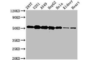 Western Blot Positive WB detected in: 293T whole cell lysate, U251 whole cell lysate, A549 whole cell lysate, HepG2 whole cell lysate, Hela whole cell lysate, Rat kidney tissue, Mouse heart tissue All lanes: SLC25A24 antibody at 5 μg/mL Secondary Goat polyclonal to rabbit IgG at 1/50000 dilution Predicted band size: 54, 52 kDa Observed band size: 54 kDa (SLC25A24 Antikörper  (AA 1-197))