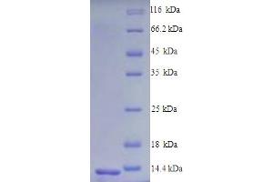 SDS-PAGE (SDS) image for Chemokine (C-C Motif) Receptor 5 (CCR5) (AA 263-354), (partial) protein (His tag) (ABIN5713330) (CCR5 Protein (AA 263-354, partial) (His tag))