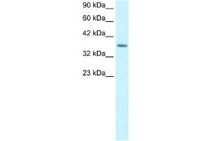 WB Suggested Anti-RPS16 Antibody Titration:  1. (RPS16 Antikörper  (Middle Region))