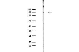anti-Zinc Finger Protein 423 (Znf423) antibody
