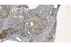 IHC analysis of HP1 alpha/CBX5 using anti-HP1 alpha/CBX5 antibody (ABIN7599057). (CBX5 Antikörper  (AA 1-191))