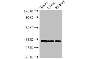 Western Blot Positive WB detected in: Mouse heart tissue, Mouse liver tissue, Mouse kidney tissue All lanes: CCND2 antibody at 3. (Cyclin D2 Antikörper  (AA 215-285))