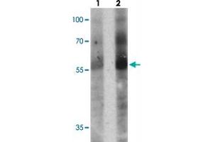 Western blot analysis of TOX in human colon tissue with TOX polyclonal antibody  at (1) 1 and (2) 2 ug/mL. (TOX Antikörper  (N-Term))