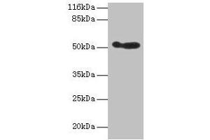 Western blot All lanes: ALDH3A1 antibody at 2 μg/mL + 293T whole cell lysate Secondary Goat polyclonal to rabbit IgG at 1/10000 dilution Predicted band size: 51 kDa Observed band size: 51 kDa (ALDH3A1 Antikörper  (AA 210-453))