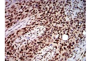 Immunohistochemistry (IHC) image for anti-DEAD (Asp-Glu-Ala-Asp) Box Polypeptide 1 (DDX1) (AA 642-740) antibody (ABIN5542504)