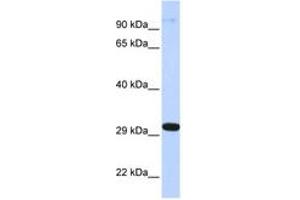 Image no. 1 for anti-Zinc Finger Protein 688 (ZNF688) (AA 72-121) antibody (ABIN6742728) (ZNF688 Antikörper  (AA 72-121))