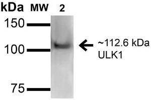 Western blot analysis of Human HeLa and 293Trap cell lysates showing detection of 112. (ULK1 Antikörper  (AA 567-577) (Biotin))
