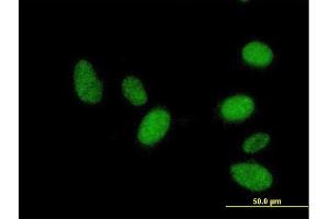 Immunofluorescence of purified MaxPab antibody to RNF36 on HeLa cell. (TRIM69 Antikörper  (AA 1-341))