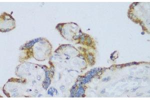 Immunohistochemistry of paraffin-embedded Human placenta using CYP11A1 Polyclonal Antibody at dilution of 1:150 (40x lens). (CYP11A1 Antikörper)
