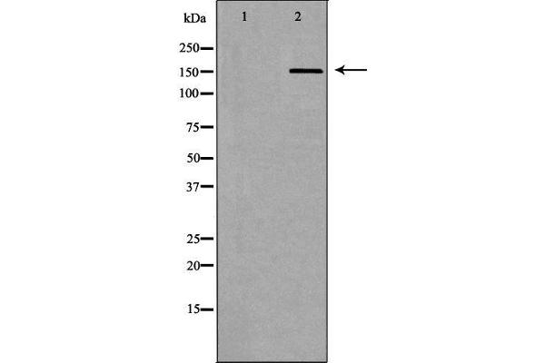 ABCC5 Antikörper  (N-Term)