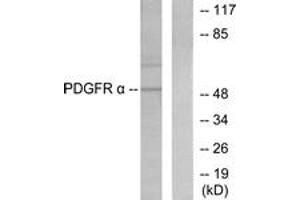 Western blot analysis of extracts from HepG2 cells, using Peripherin Antibody. (Peripherin Antikörper  (AA 421-470))