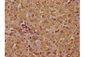 IHC image of ABIN7169187 diluted at 1:300 and staining in paraffin-embedded human liver tissue performed on a Leica BondTM system. (TAO Kinase 1 (TAOK1) (AA 400-659) Antikörper)