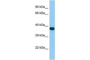 Host:  Rabbit  Target Name:  Zfp367  Sample Type:  Rat Spleen lysates  Antibody Dilution:  1. (ZNF367 Antikörper  (C-Term))