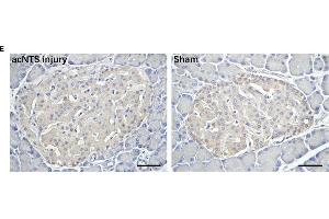 Changes in adrenal glands and pancreas in acNTS injured mice. (Insulin Antikörper  (AA 46-59))