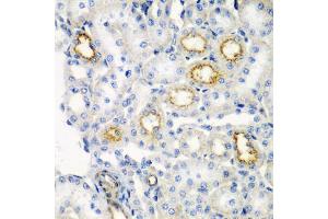 Immunohistochemistry of paraffin-embedded rat kidney using RARRES2 antibody (ABIN5974187) at dilution of 1/200 (40x lens). (Chemerin Antikörper)