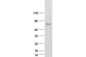 CPVL Protein (Transcript Variant 1) (Myc-DYKDDDDK Tag)