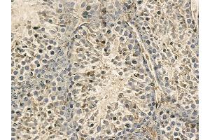 DNAAF1 Mouse Monoclonal Antibody at 1/100 staining mouse testis tissue by IHC-P. (LRRC50 Antikörper)