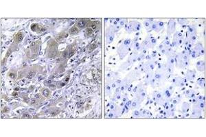 Immunohistochemistry (IHC) image for anti-Mitochondrial Ribosomal Protein S18A (MRPS18A) (AA 81-130) antibody (ABIN2890041) (MRPS18A Antikörper  (AA 81-130))