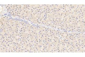 Immunohistochemistry (IHC) image for anti-Receptor Tyrosine Kinase-Like Orphan Receptor 1 (ROR1) (AA 540-795) antibody (ABIN7439615)