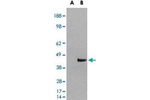 HEK293 overexpressing SNX16 and probed with SNX16 polyclonal antibody  (mock transfection in first lane), tested by Origene. (SNX16 Antikörper)