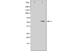 Western blot analysis of extracts of human heart tissue, using MYOC antibody. (MYOC Antikörper  (Internal Region))